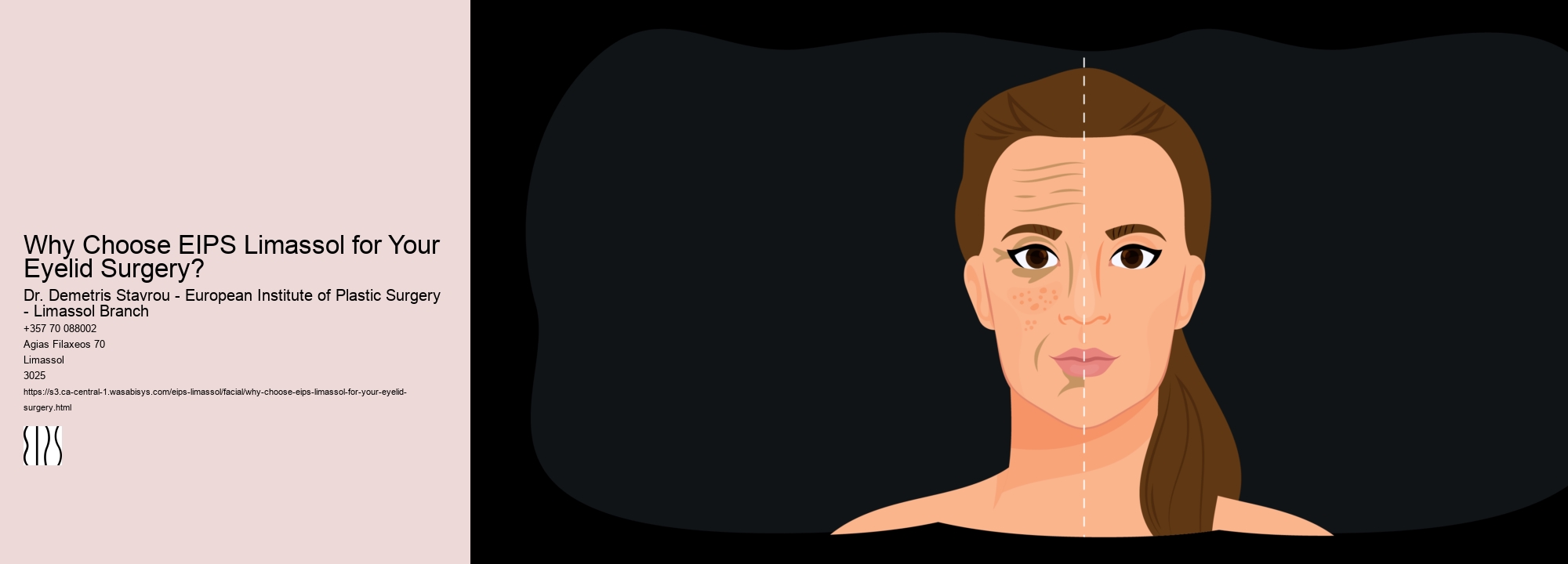 Why Choose EIPS Limassol for Your Eyelid Surgery?